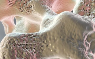 Mineralometria Ossea Computerizzata (M.O.C.): cos’è e come funziona