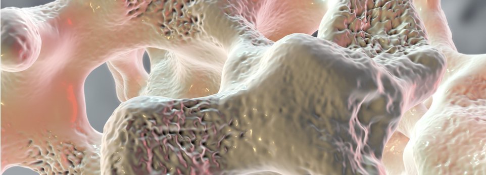 Mineralometria Ossea Computerizzata (M.O.C.): cos’è e come funziona